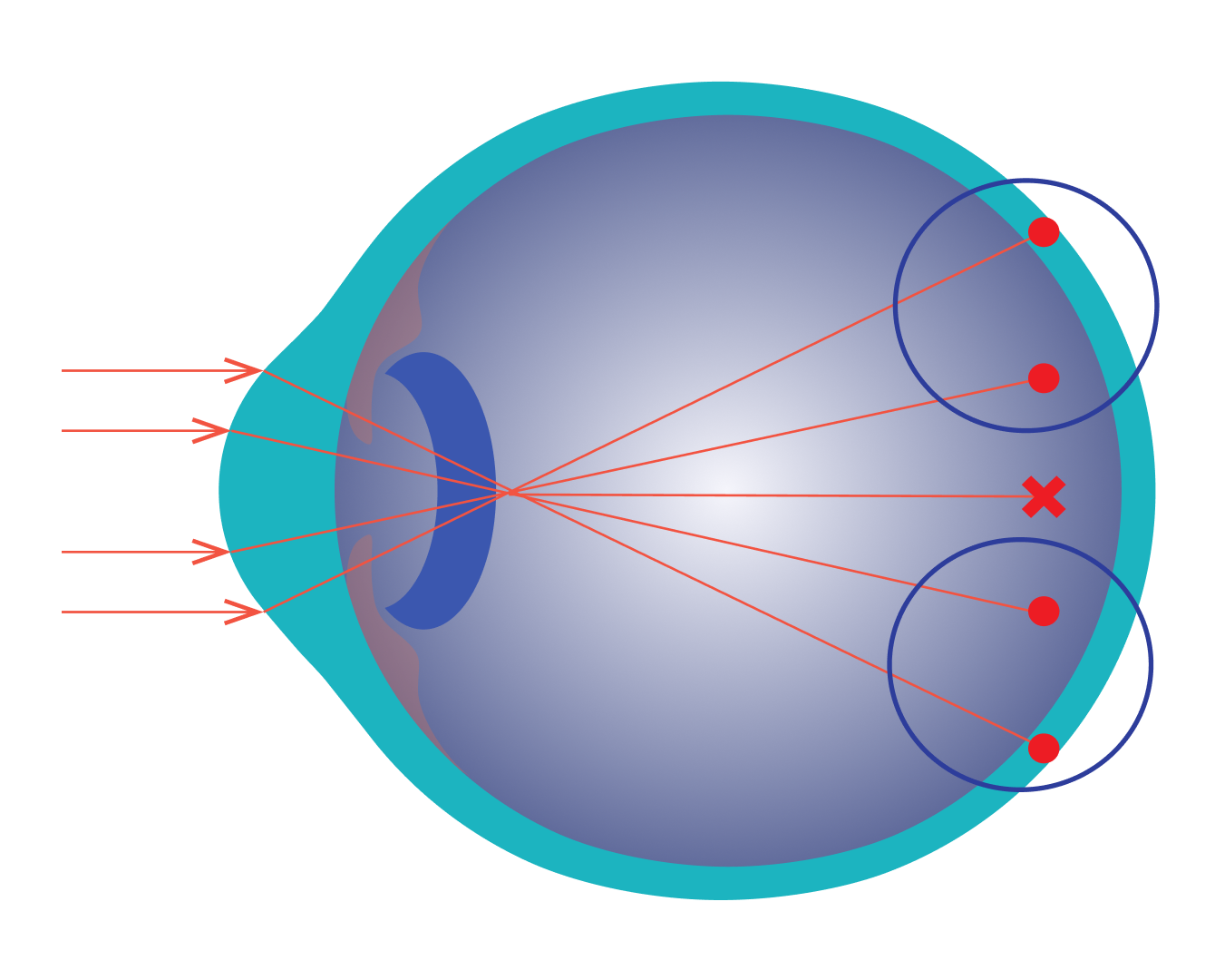 MoonLens